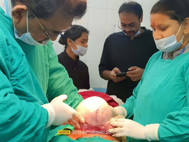 गोपेश्वर : डॉ. पुनेठा के नेतृत्व में चिकित्सा टीम ने महिला के पेट से निकला पांच किलो का ट्यूमर
